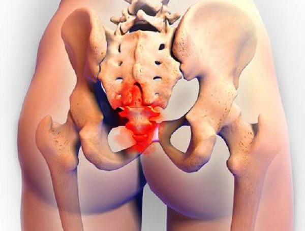 Pubic bone pain from cycling - has anyone experienced pain here? Worried I  somehow stress fractured my pelvis but hoping it's just from a lot of time  on the trainer and a
