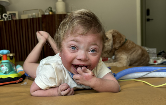 diagnostic overshadowing thiamine